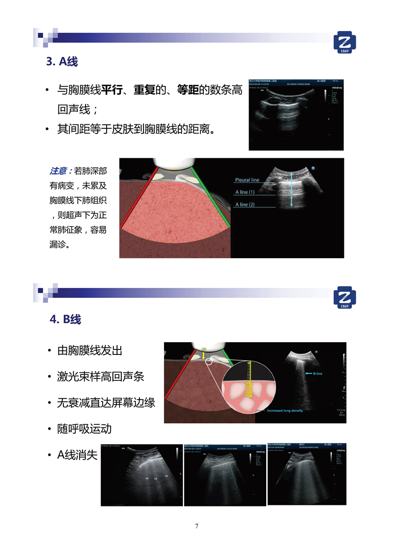 新冠肺超聲實用手冊(2)_35.jpg